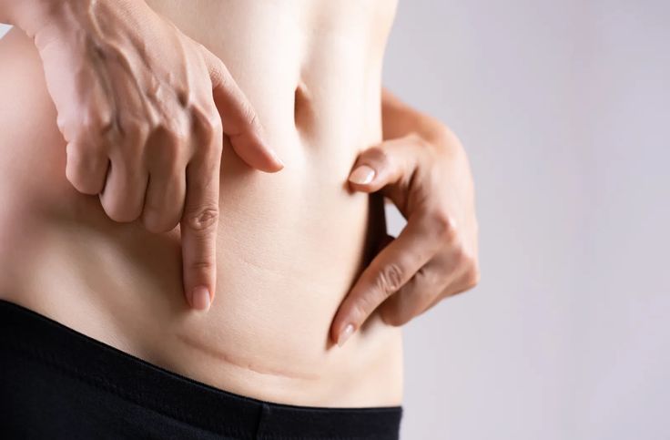 Story pin image