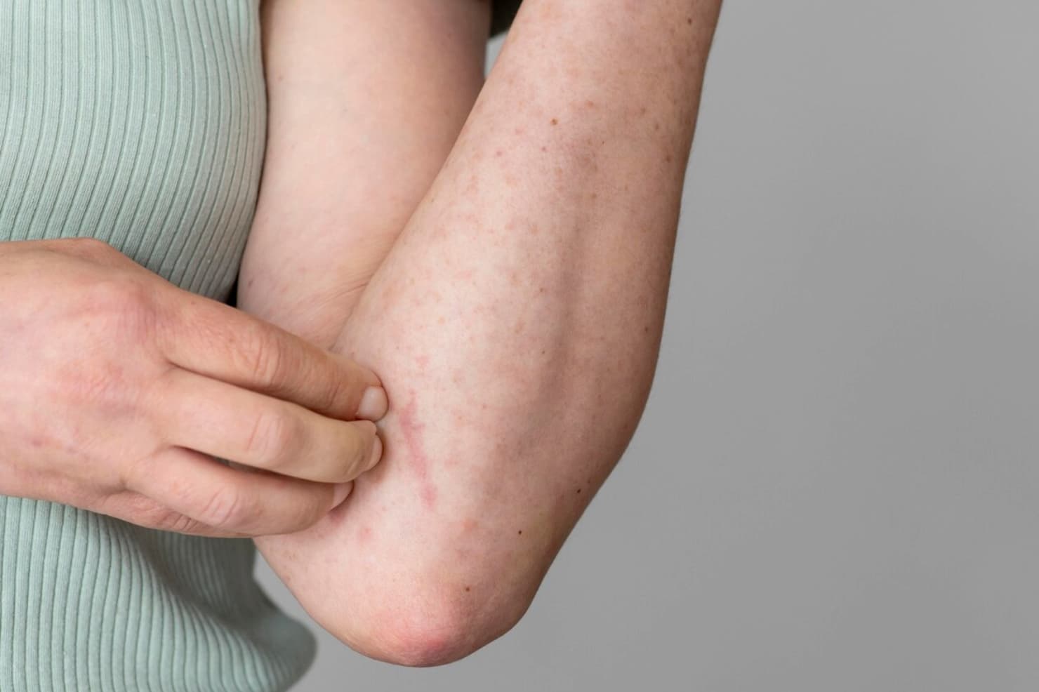 Chicken Skin di Badan? Ini 7 Solusi Ampuh Menghaluskannya