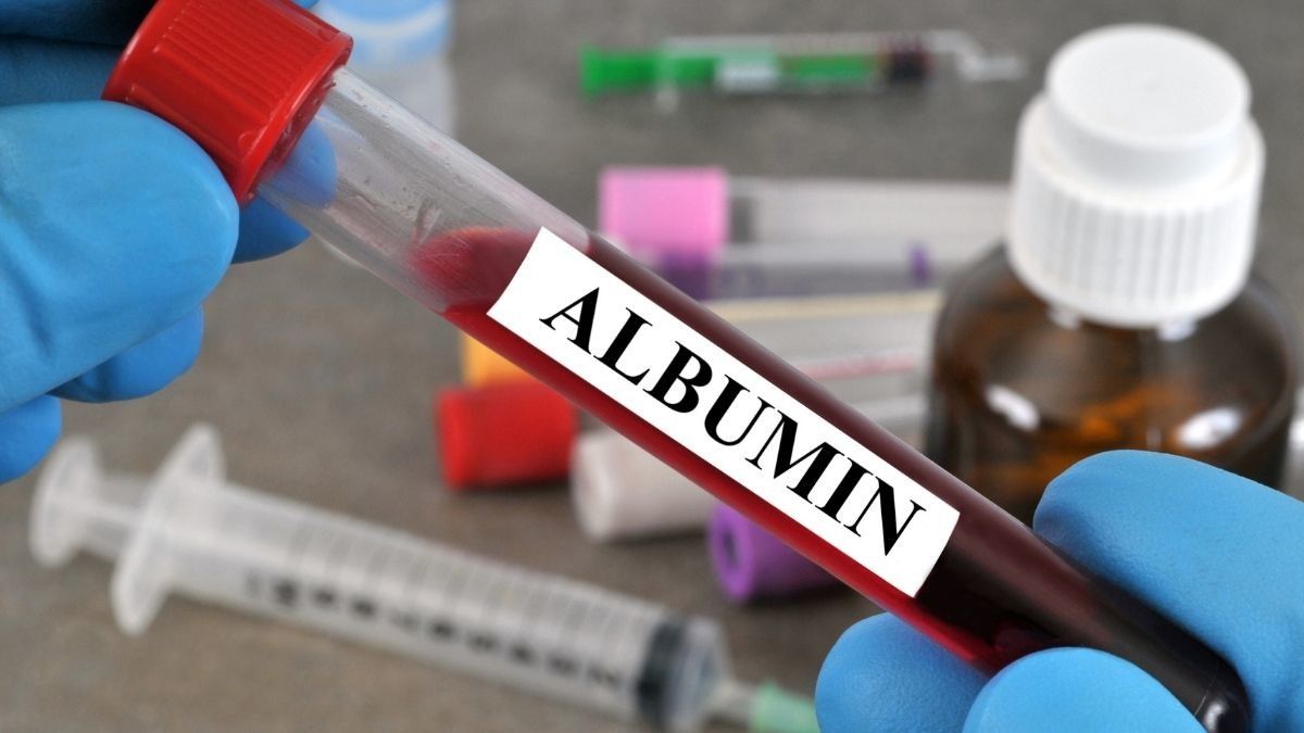 Mengenal Albumin, Kadar Normal dan Fungsinya - KlikDokter